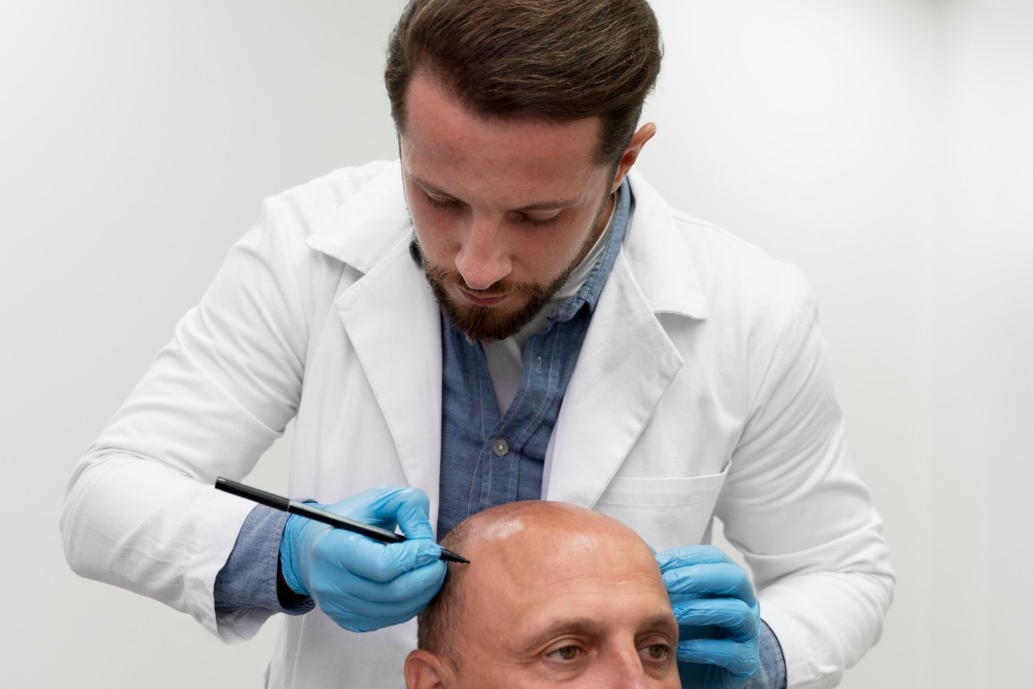 Planning for Hair Transplant: Cost Breakdown and Tips
