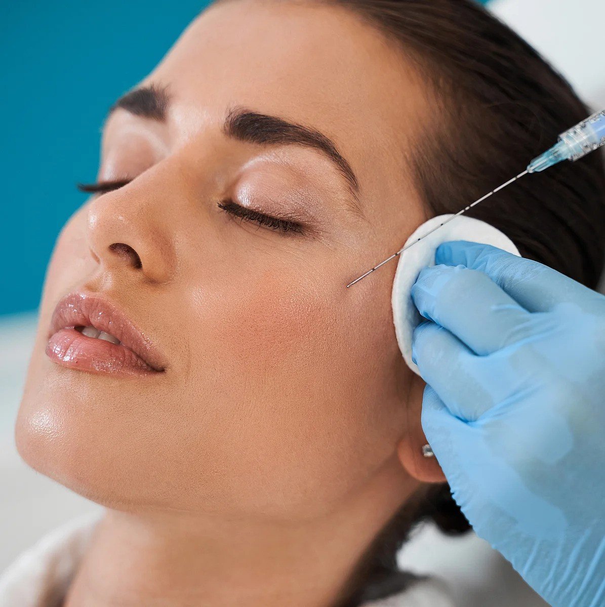 Filler Fundamentals: Sculptra vs Radiesse for Every Face