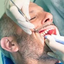 Can Root Canal Treatment in Islamabad Prevent Tooth Loss?