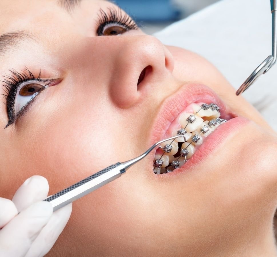 Dentistry on Mississauga Enhancing Smiles Through Modern Cosmetic Dentistry