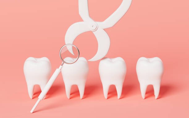 How Tooth Extractions Can Prevent Future Dental Complications
