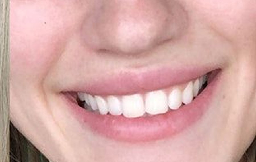 Enfield Dental Clinic Dubai: Comprehensive Cosmetic Dentistry Services