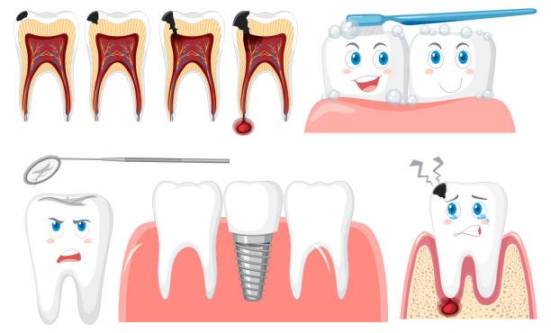 Can a Root Canal Save Your Tooth? Exploring the Benefits