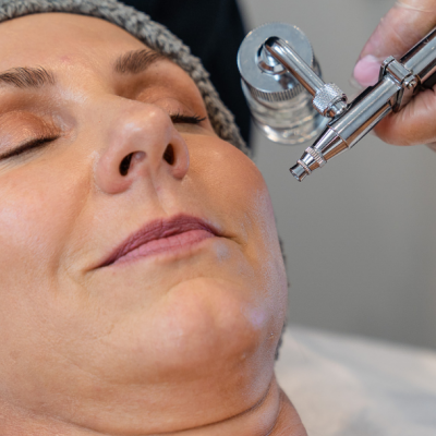 Do Oxygen Facials Boost Skin Hydration Levels?