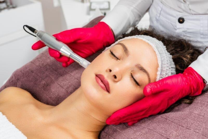 How Many Microneedling Sessions Are Needed?